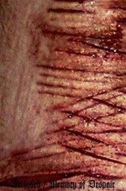 I'm In A Coffin : Secluded, Memory of Despair